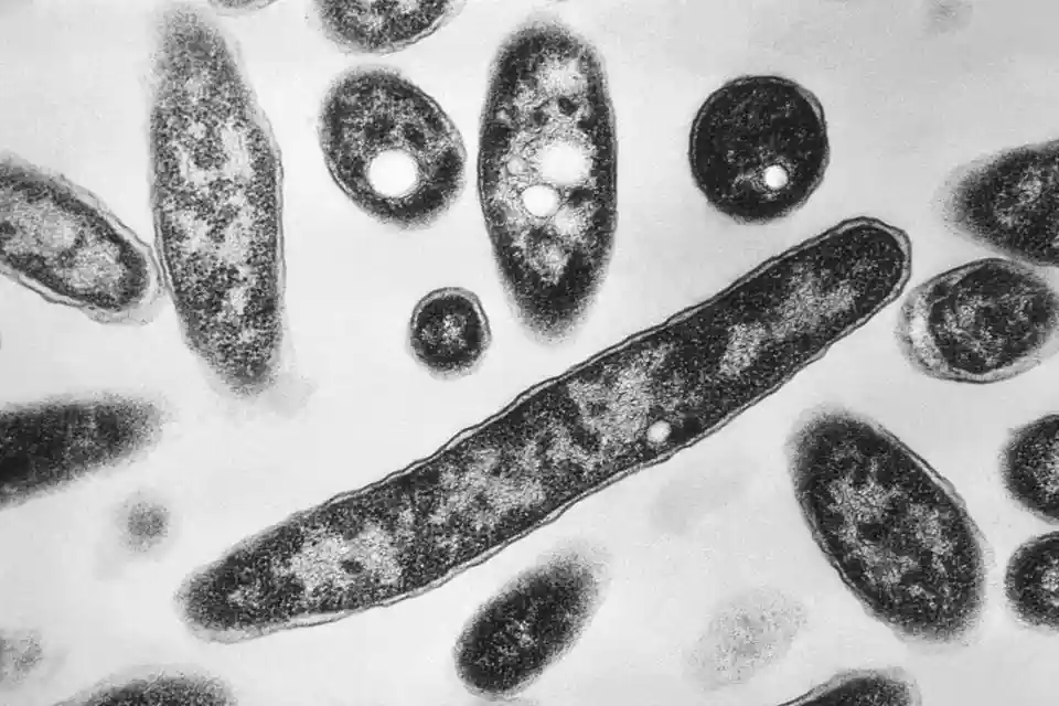 Legionnaires’ disease death in NYC as outbreak source sought